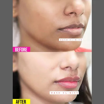 Pakistan's Best Skin Whitening Serum - Gluta White